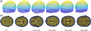 Age-averaged MRI templates. (a) 3D mesh of the contour of each atlas along with the source (red) and detectors locations (black). (b) Axial view of the plane where source and detectors were placed (scalp in dark blue, skull in light blue, CSF in brown, and brain in yellow).